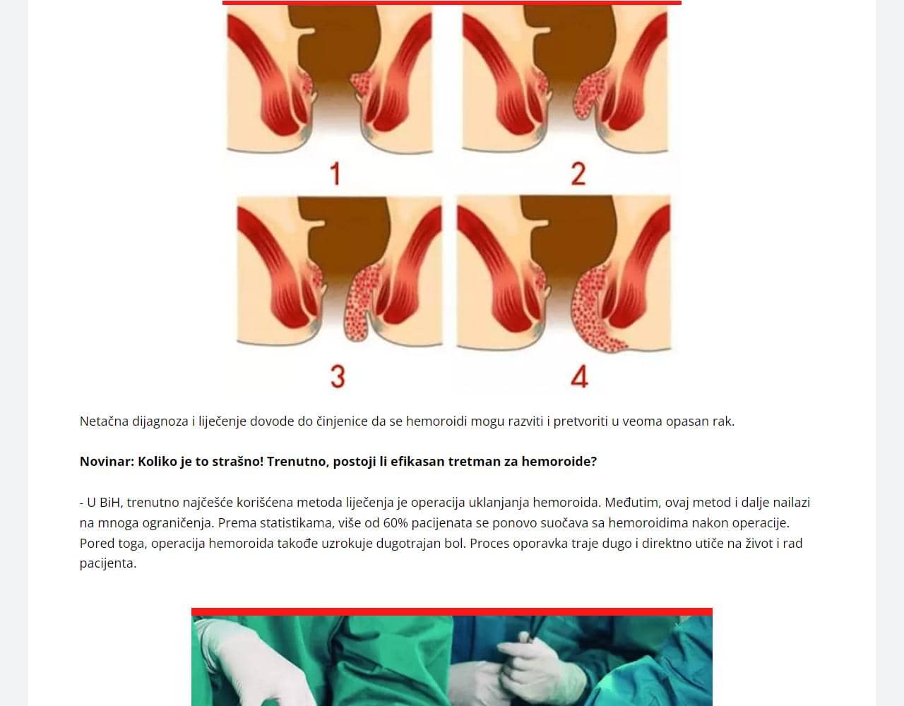 Hemorodon 3